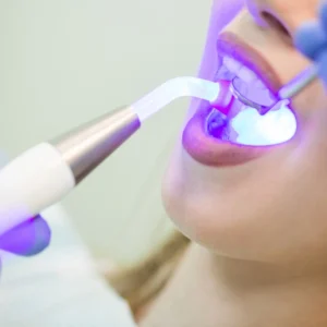 Avances y competencias en estética dental para higienistas