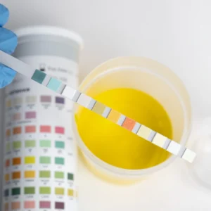 El proceso analítico integral de muestras urinarias